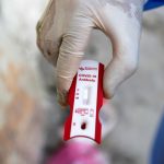 Governo Federal anuncia parceria para produzir vacina contra o Novo Coronavírus