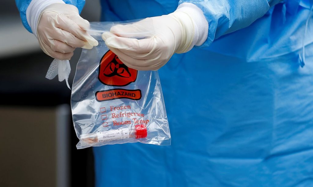 Estudo revela grande descoberta de pesquisadores sobre contaminação do Novo Coronavírus