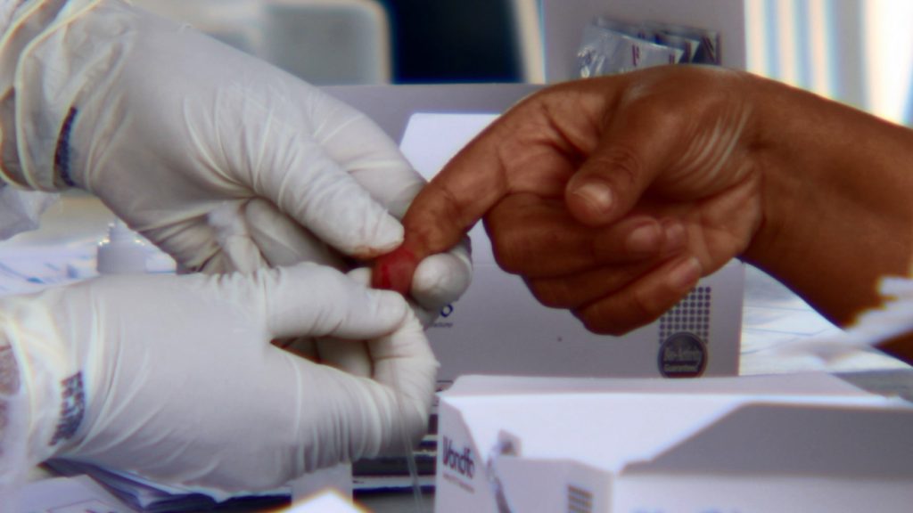 Prefeitura de Feira adquire mais testes rápidos para Covid-19