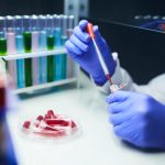 Justiça desobriga planos de saúde a cobrir teste de Covid