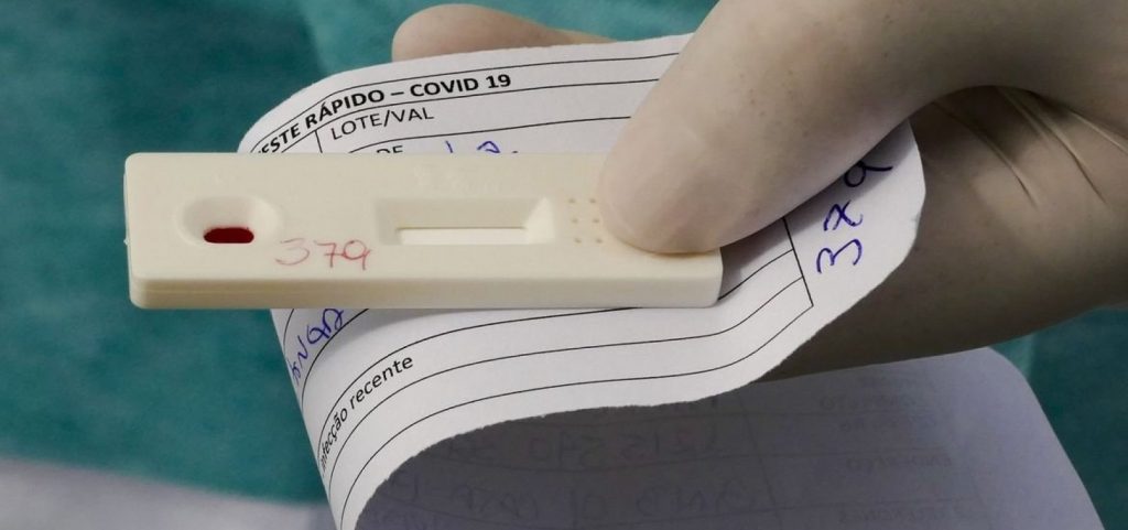 Ministério da Saúde obriga laboratórios a notificar em até 24h resultados de testes da Covid-19