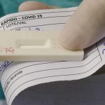 Ministério da Saúde obriga laboratórios a notificar em até 24h resultados de testes da Covid-19