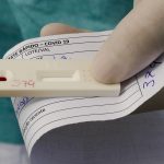 Saiba como fazer o teste diagnóstico de covid-19 pelo plano de saúde