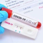 Covid: 6 meses após 1º caso, Feira de Santana registra redução no número de infectados
