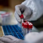 Taxa de mortos entre os infectados pelo novo coronavírus é inferior a 0,20%