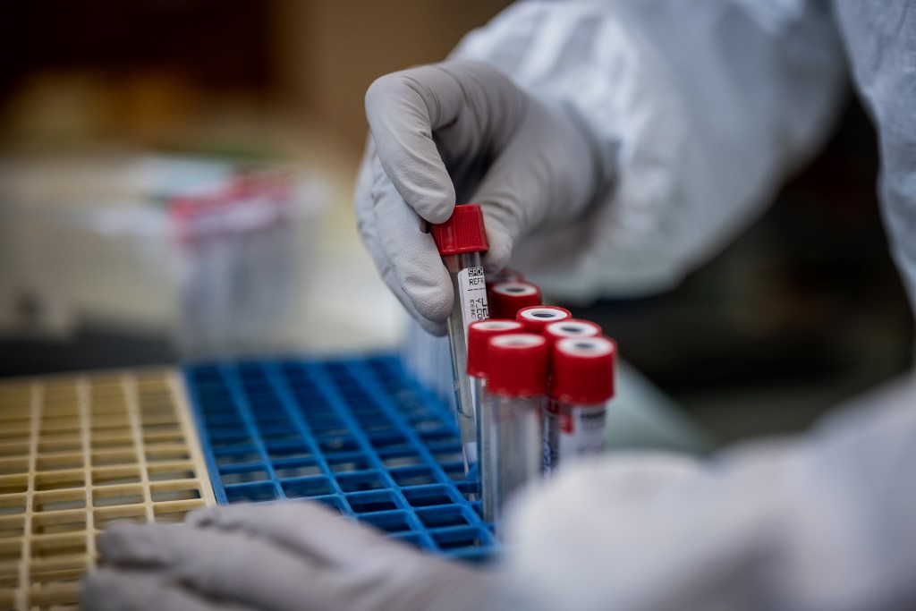 Taxa de mortos entre os infectados pelo novo coronavírus é inferior a 0,20%