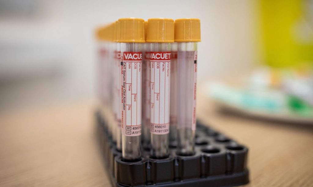 Covid-19: Com mais de 10 mil curados, Feira não registra óbitos neste fim de semana