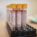 Em 7 meses de pandemia, Bahia é o 2º estado com mais casos da Covid-19 no Brasil