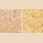 Novo estudo mapeia as semelhanças entre o cérebro humano e o universo