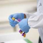 Ministério da Saúde confirma 2º caso de reinfecção da Covid-19 no Brasil