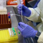 Pandemia da Covid reduz testes de HIV e atrasa tratamento com antirretroviral