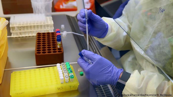 Pandemia da Covid reduz testes de HIV e atrasa tratamento com antirretroviral