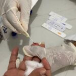 Feira de Santana tem redução em casos de sífilis