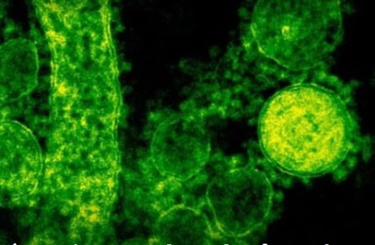 Alerta: Vírus “comedor de ânus” se espalha e gera preocupação