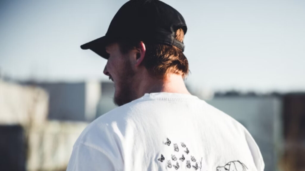 Boné causa calvície? Especialista explica se há risco de queda capilar