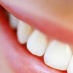Conheça os hábitos comuns que são capazes de afetar a saúde dos seus dentes