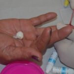 Ações de prevenção e diagnóstico das hepatites virais são intensificadas durante o Julho Amarelo