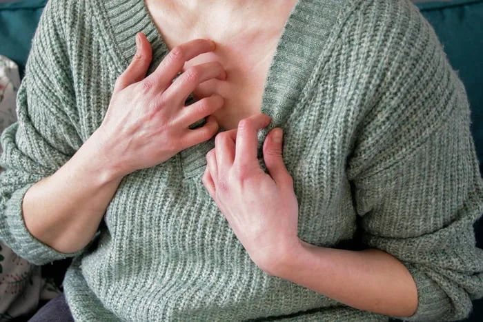 Confira 6 alimentos que devem ser evitados por “atacar” a dermatite