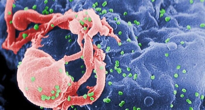 Nova Variante do HIV descoberta no Brasil
