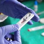 O que se sabe sobre a nova variante do HIV que circula em 3 estados