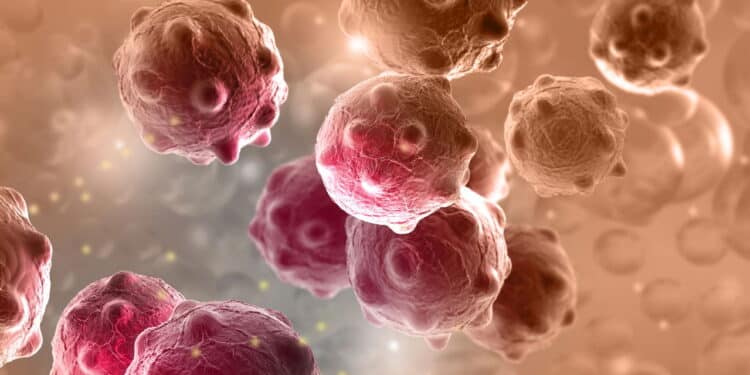 Alerta: conheça três tipos de cânceres silenciosos que você pode estar ignorando; veja sinais