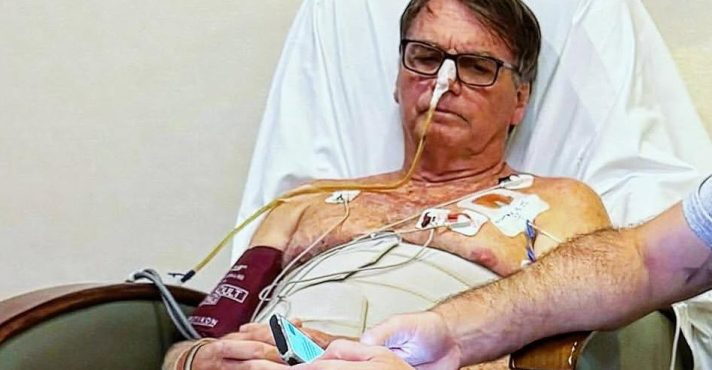 Bolsonaro apresenta piora e passa por tomografia no DF Star