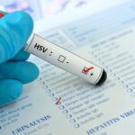 Herpes genital: o que é, sintomas e como tratar