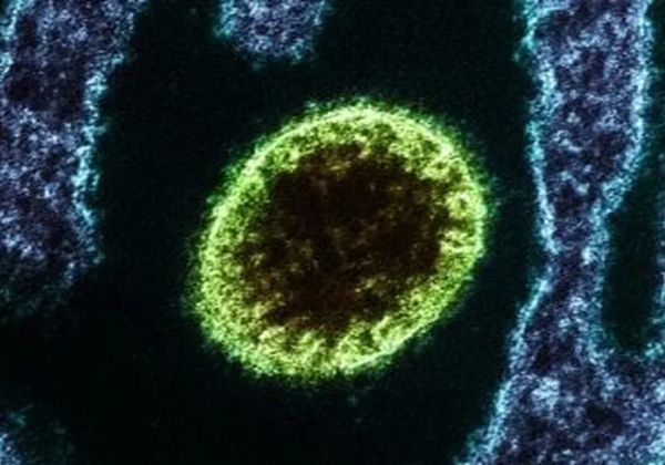 Ministério da Saúde faz alerta sobre novo vírus Nipah e risco de contaminação no país