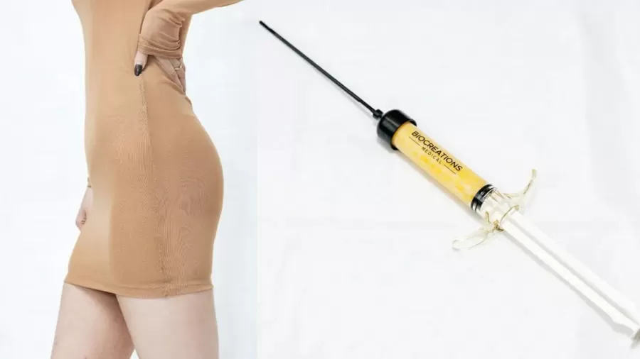 Novo procedimento estético nos EUA injeta gordura de mortos: ‘Reciclando’