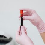 Exame de sangue amplia chance de detectar câncer de pâncreas em estágios mais precoces